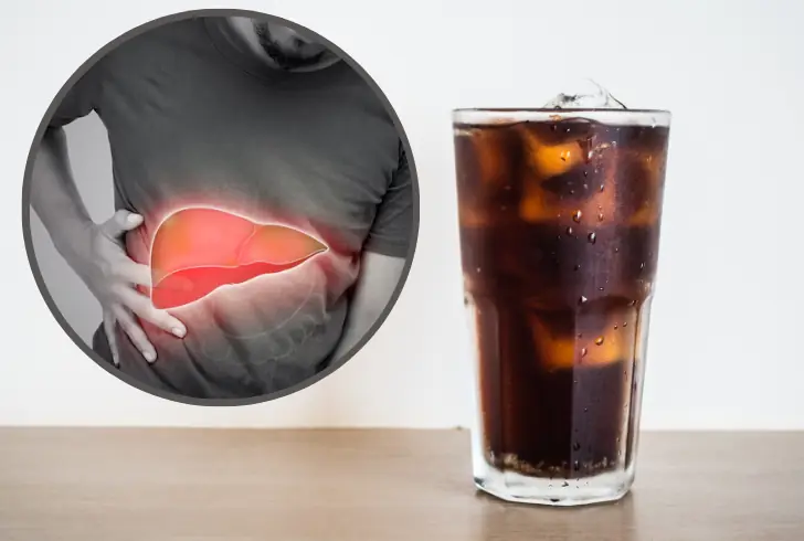 Liver illustration soda risk